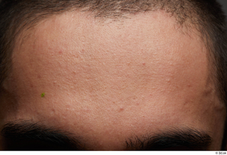HD Face Skin Shawn Jacobs face forehead skin pores skin…